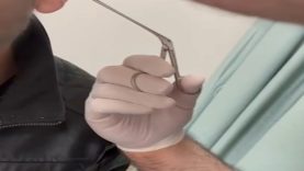 Kayseri'de akıllara durgunluk veren olay! Kulağından uyuşturucu çıktı