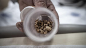 İdrar kanalından 51 taş çıkarıldı