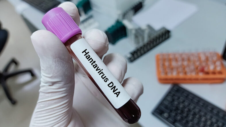 Dünyada hantavirüs alarmı! Tedavi ve aşı çalışmalarında son durum