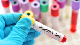 Sağlık Bakanlığı duyurdu! Hepatit A aşısı ilk kez Türkiye'de üretildi! 81 ilde kullanıma sunuldu