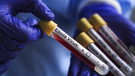 ebolaya-karsi-yeni-umut-ilk-deneysel-asi-insanda-denendi.jpg
