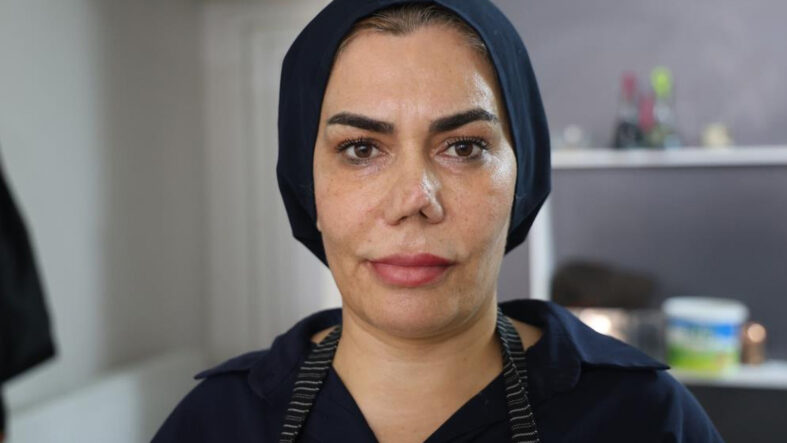 burnu-kirildi-dort-operasyon-gecirdi-her-ameliyattan-sonra-yeni-bir-burun-ortaya-cikti.jpg