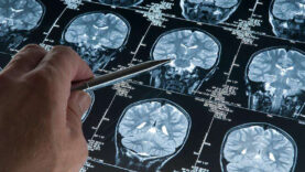 derin-uyku-alzheimer-hastaliginin-ilerlemesini-durduruyor.jpg