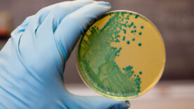 listeria-riski-yayiliyor-peynirde-kuresel-alarm-endisesi.jpg