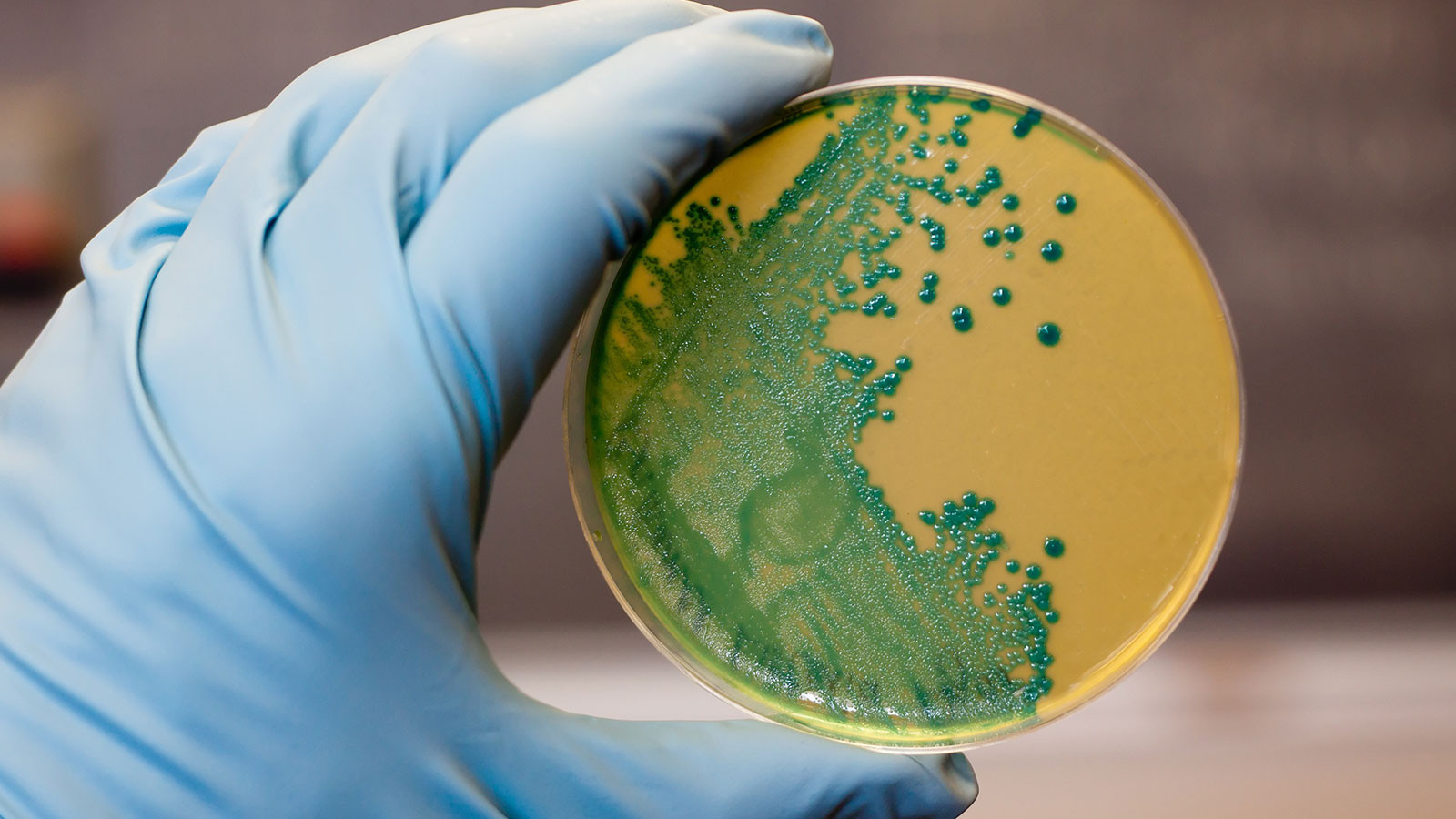 Listeria riski yayılıyor, peynirde küresel alarm endişesi
